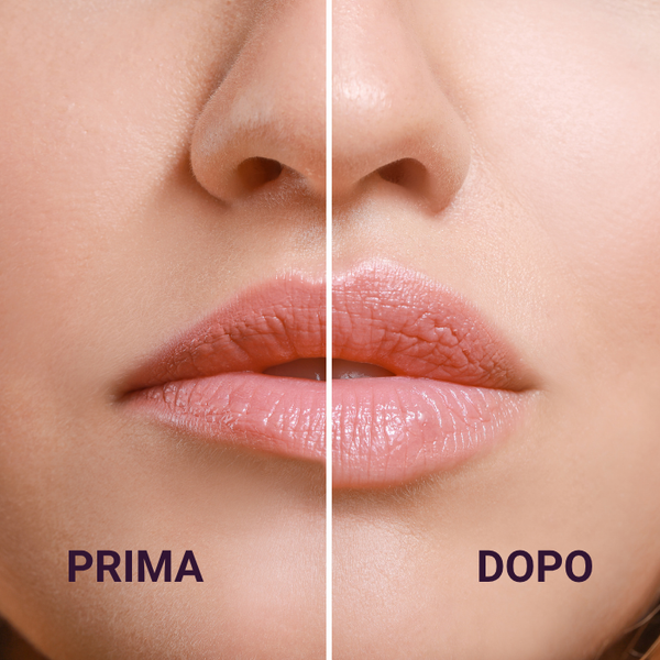Lip Booster Effetto Rimpolpante